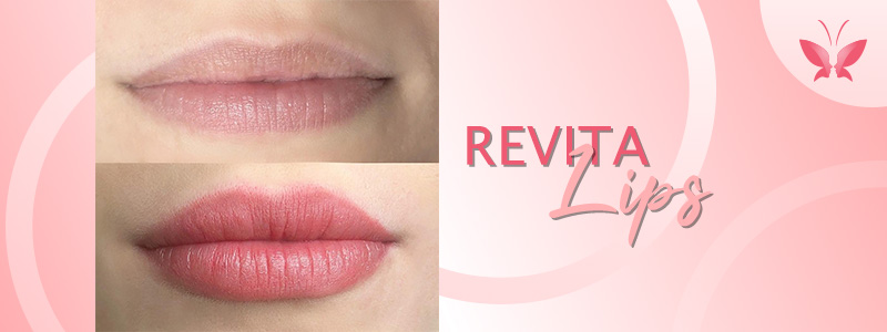 Revita Lips